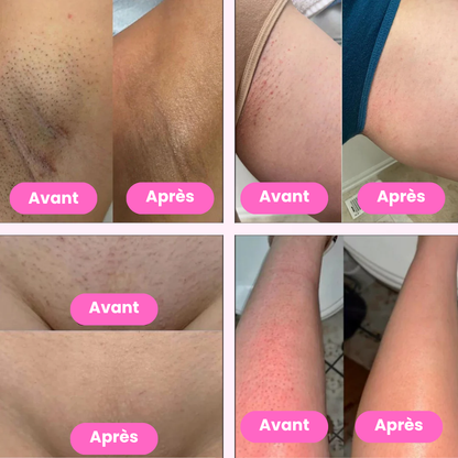 épilateur électrique classique rose